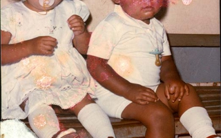 'Um casal de bebê vestidos de branco, a menina com o bico na boca e o menino com o bico pendurado no pescoço década de 80